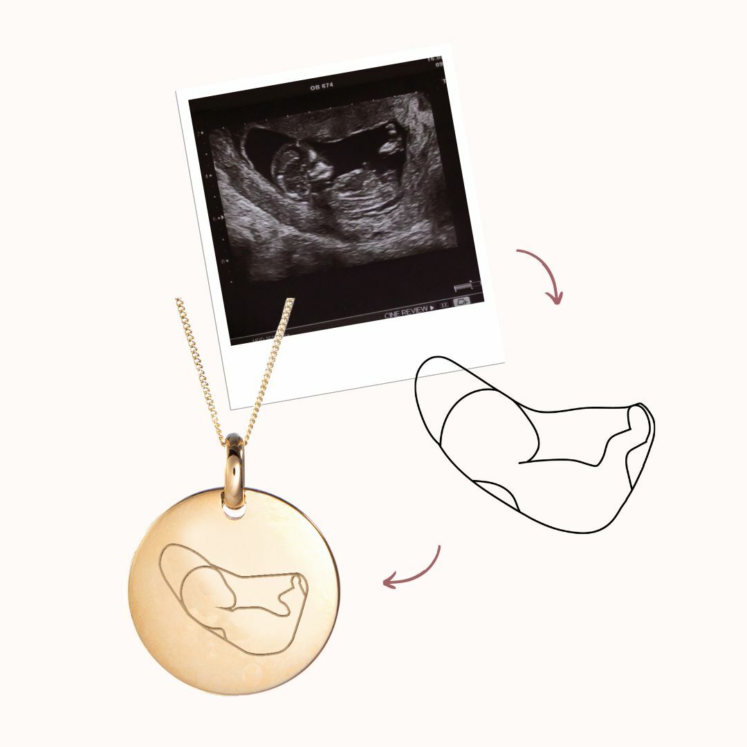 Ultrasound Illustration Coin Necklace - Gold plated